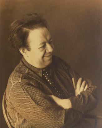 Diego Rivera (right shoulder)